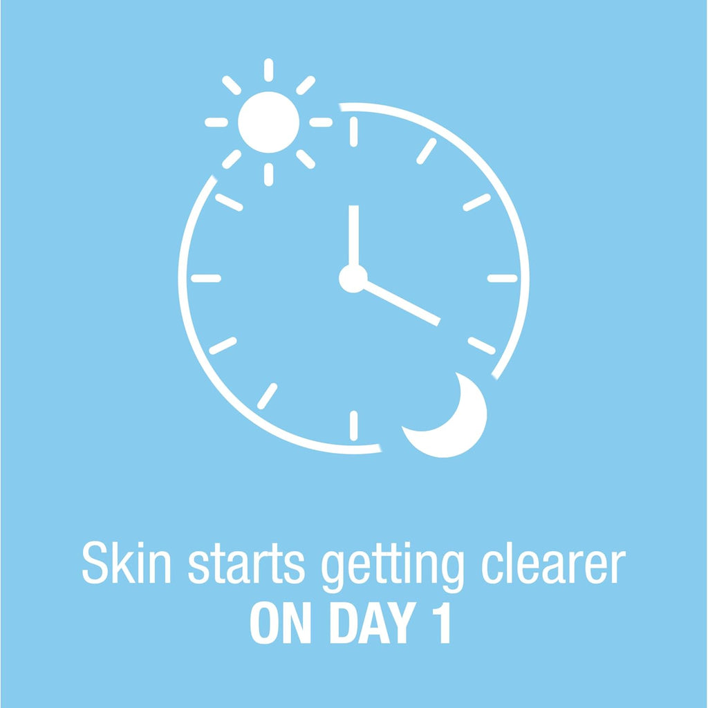 Neutrogena On-The-Spot Acne Spot Treatment Cream with 2.5% Benzoyl Peroxide, Gentle Face Blemish Medicine for Acne-Prone Skin, Vanishing Formula, Clinically Proven Day-1 Results, 0.75-Ounce Tube